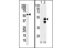 Image no. 1 for anti-Protein Phosphatase 1F (PP2C Domain Containing) (PPM1F) (N-Term) antibody (ABIN360800) (PPM1F 抗体  (N-Term))