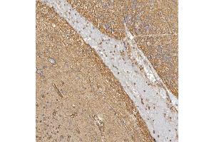 IHC analysis of Sm-D3/SNRPD3 using anti-Sm-D3/SNRPD3 antibody (ABIN7598952). (SNRPD3 抗体  (AA 1-112))