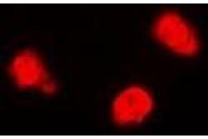 Immunofluorescent analysis of TIP60 staining in Jurkat cells. (KAT5 抗体)