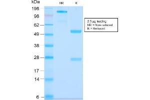 SDS-PAGE Analysis Purified MUC3 Rabbit Recombinant Monoclonal Antibody (MUC3/2992R). (Recombinant MUC3A 抗体)