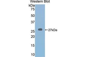 Western blot analysis of the recombinant protein. (LOXL2 抗体  (AA 553-761))