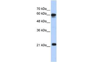 WB Suggested Anti-SEMA4F Antibody Titration:  0. (SEMA4F 抗体  (N-Term))