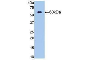Detection of Recombinant NT5E, Rat using Monoclonal Antibody to Cluster Of Differentiation 73 (CD73) (CD73 抗体  (AA 29-550))