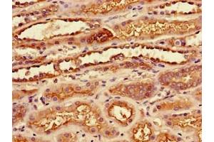 Immunohistochemistry of paraffin-embedded human kidney tissue using ABIN7175933 at dilution of 1:100