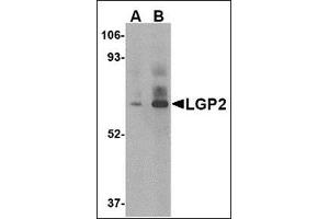 Western blot analysis of LGP2 in rat kidney tissue lysate with this product at (A) 1 and (B) 2 μg/ml. (DHX58 抗体  (C-Term))