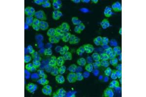 Staining of a cytospin preparation of peripheral blood mononuclear cells isolated from buffycoat. (Cathelicidin 抗体)