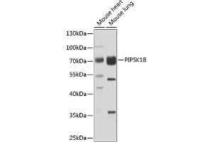 Western blot analysis of extracts of various cell lines, using PIP5K1B antibody (ABIN6130645, ABIN6145684, ABIN6145686 and ABIN6223693) at 1:1000 dilution. (PIP5K1B 抗体  (AA 190-470))