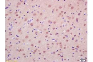 Formalin-fixed and paraffin embedded rat brain labeled with Anti-RASSF2 Polyclonal Antibody, Unconjugated (ABIN681988) at 1:200 followed by conjugation to the secondary antibody and DAB staining. (RASSF2 抗体  (AA 201-300))