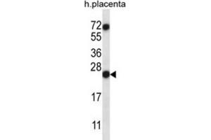 Western Blotting (WB) image for anti-Ribonuclease, RNase A Family, 8 (RNASE8) antibody (ABIN2997335) (RNASE8 抗体)
