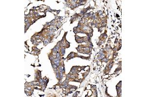 IHC analysis of EPB41L5 using anti-EPB41L5 antibody (ABIN7601550). (EPB41L5 抗体  (AA 38-733))