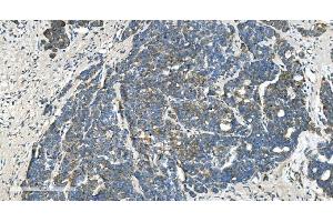 IHC analysis of TIMM8A/DDP using anti-TIMM8A/DDP antibody (ABIN7600039). (TIMM8A/DDP 抗体  (AA 14-97))