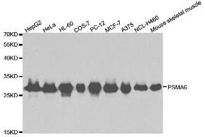 Western blot analysis of extracts of various cell lines, using PSMA6 antibody. (PSMA6 抗体  (AA 1-246))