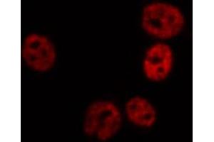 ABIN6267689 staining HT29 by IF/ICC. (FANCD2 抗体  (pSer222))