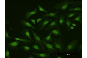 Immunofluorescence of purified MaxPab antibody to HHEX on HeLa cell. (HHEX 抗体  (AA 1-270))