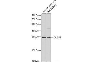 Western blot analysis of extracts of various cell lines using DUSP3 Polyclonal Antibody at dilution of 1:3000.