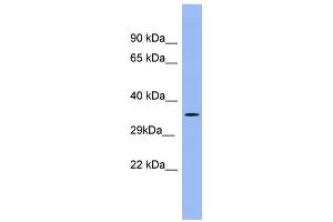 WB Suggested Anti-PSG5 Antibody Titration:  0. (PSG5 抗体  (Middle Region))
