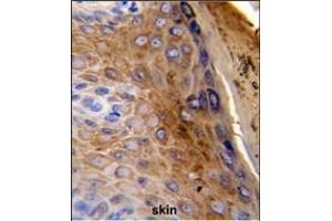 Formalin-fixed and paraffin-embedded human skin reacted with KRT10 Antibody (Center), which was peroxidase-conjugated to the secondary antibody, followed by DAB staining. (Keratin 10 抗体  (AA 318-346))