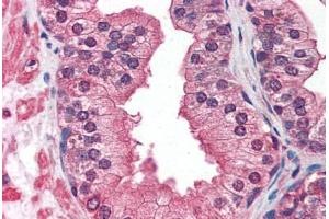 Prostate: Formalin-Fixed, Paraffin-Embedded (FFPE) (IGF1R 抗体)