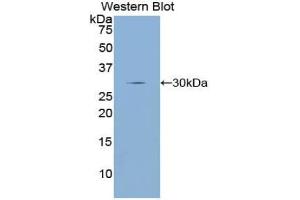 Western blot analysis of the recombinant protein. (Dopamine d2 Receptor 抗体  (AA 194-421))