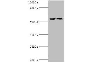 Western blot All lanes: CASP8 antibody at 2 μg/mL Lane 1: ACCM whole cell lysate Lane 2: LO2 whole cell lysate Secondary Goat polyclonal to rabbit IgG at 1/10000 dilution Predicted band size: 56, 54, 46, 58, 28, 26, 33, 31, 62 kDa Observed band size: 56 kDa (Caspase 8 抗体  (AA 217-374))