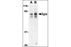 Western blot analysis of lipe in human lymph node tissue lysate with this product at (A) 0. (LIPE 抗体  (C-Term))