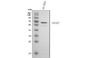 Western blot analysis of NPFFR2 using anti-NPFFR2 antibody (ABIN7600027).