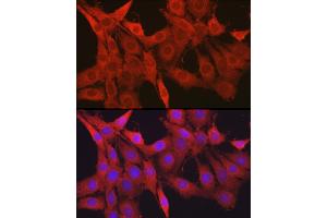 Immunofluorescence analysis of PC-12 cells using Galectin 1/LG Rabbit pAb (ABIN6130424, ABIN6143156, ABIN6143157 and ABIN6218649) at dilution of 1:50 (40x lens). (LGALS1/Galectin 1 抗体  (AA 1-135))