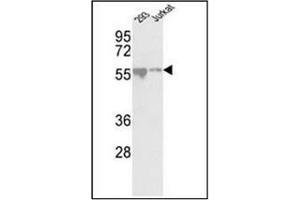 Western blot analysis of CDKL2 antibody (Center) in 293, Jurkat cell line lysates (35ug/lane).