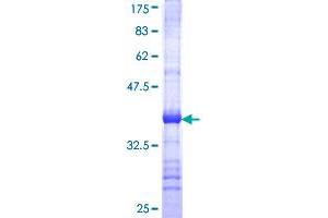 MTRR Protein (AA 1-110) (GST tag)