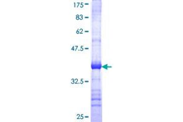 MTRR Protein (AA 1-110) (GST tag)