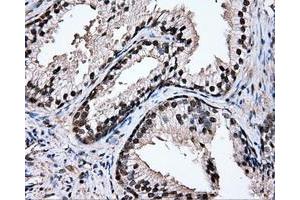 Immunohistochemical staining of paraffin-embedded prostate tissue using anti-TIPRLmouse monoclonal antibody. (TIPRL 抗体)