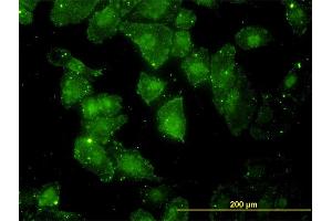Immunofluorescence of monoclonal antibody to GCLC on HeLa cell. (GCLC 抗体  (AA 528-637))