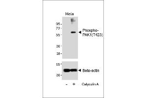Western blot analysis of lysates from Hela cell line, untreated or treated with EGF(1 μg/mL, 10 min), using Phospho-K1 Antibody (upper) or Beta-actin (lower). (PAK1 抗体  (pThr423))