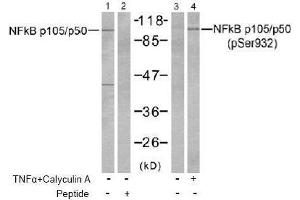 Image no. 2 for anti-Nuclear Factor of kappa Light Polypeptide Gene Enhancer in B-Cells 1 (NFKB1) (pSer932) antibody (ABIN197008) (NFKB1 抗体  (pSer932))