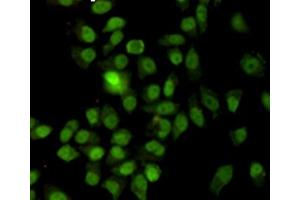 Immunocytochemistry staining of HeLa cells fixed with -20 °C Methanol and using anti-Ku70 antibody (dilution 1:200). (XRCC6 抗体)