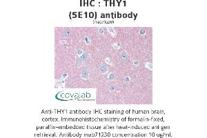 Image no. 2 for anti-CD90 (THY1) antibody (ABIN1724058) (CD90 抗体)