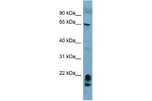 WB Suggested Anti-FAM134A Antibody Titration:  0. (FAM134A 抗体  (N-Term))