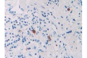 Used in DAB staining on fromalin fixed paraffin- embedded kidney tissue (RNASE8 抗体  (AA 19-154))
