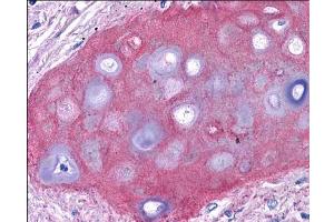 Immunohistochemistry (IHC) image for anti-Collagen, Type II, alpha 1 (COL2A1) antibody (ABIN5596824)