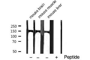 Western blot analysis of extracts of various tissue sample,using Phospho-PLCG1 (Tyr771) Antibody. (Phospholipase C gamma 1 抗体  (pTyr771))