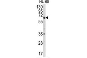 Western blot analysis of CYP2C18 Antibody (C-term) in HL-60 cell line lysates (35ug/lane). (CYP2C18 抗体  (C-Term))