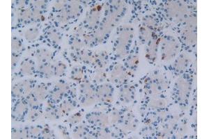 DAB staining on IHC-P; Samples: Human Stomach Tissue (FGF18 抗体  (AA 28-207))