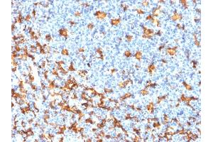Formalin-fixed, paraffin-embedded human Tonsil stained with AIF1 / Iba1 Mouse Recombinant Monoclonal Antibody (rAIF1/1909). (Recombinant Iba1 抗体  (AA 1-146))