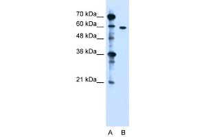 Western Blotting (WB) image for anti-Zinc Finger, DHHC-Type Containing 13 (ZDHHC13) (N-Term) antibody (ABIN630234)