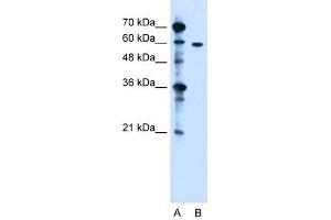 ZDHHC13 antibody used at 1. (ZDHHC13 抗体  (N-Term))