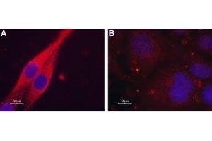 Expression of Muscarinic acetylcholine receptor M4 in C6 transfected cells - Immunocytochemical staining of paraformaldehyde-fixed and permeabilized C6 cells. (CHRM4 抗体  (AA 330-340))
