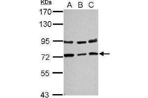 WB Image Sample (30 ug of whole cell lysate) A: NT2D1 B: PC-3 C: U87-MG 7. (NGFR 抗体)