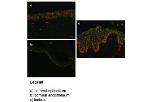 WB Suggested Anti-DPYS (dihydropyrimidinase) Antibody (Clone #:8B11)(100ug)   Titration: 0. (ZNF133 抗体  (N-Term))