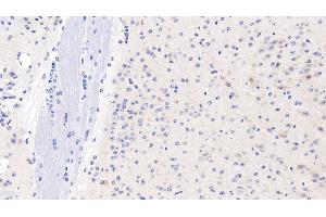 Detection of GPC1 in Mouse Cerebrum Tissue using Polyclonal Antibody to Glypican 1 (GPC1) (GPC1 抗体  (AA 155-292))