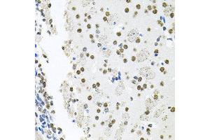 Immunohistochemistry of paraffin-embedded mouse brain using MCL1 antibody at dilution of 1:100 (x40 lens). (MCL-1 抗体)